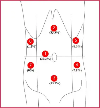 Ibs Vs Non Ibs Pain Under The Left Rib Cage How To Differentiate Dr Farahat Oh My Gut Ibs And Gut Health Blog
