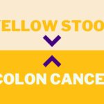 yellow stool colon cancer