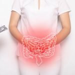 What Causes Pain A Week After Colonoscopy? (Dr. Farahat) - Oh My Gut | IBS & Gut Health Blog What Causes Pain A Week After Colonoscopy? (Dr. Farahat) - Oh My Gut | IBS & Gut Health Blog