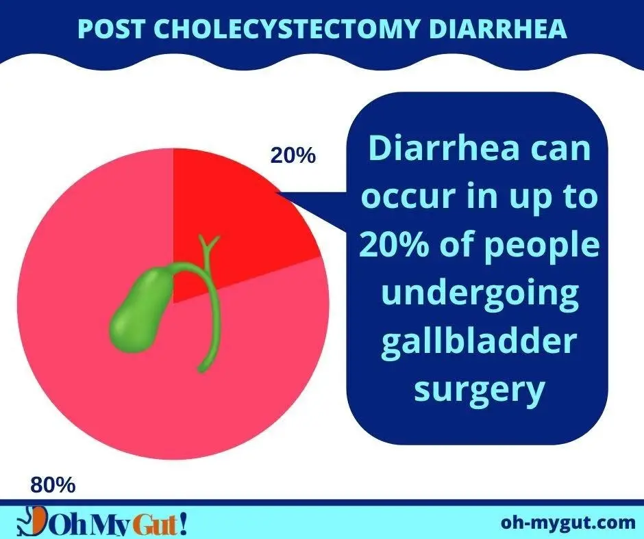 post cholecystectomy diarrhea