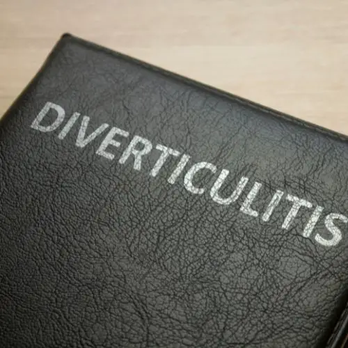 diverticulitis stool shape color