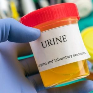 pancreatitis urine color