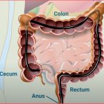 how far does colonoscopy go