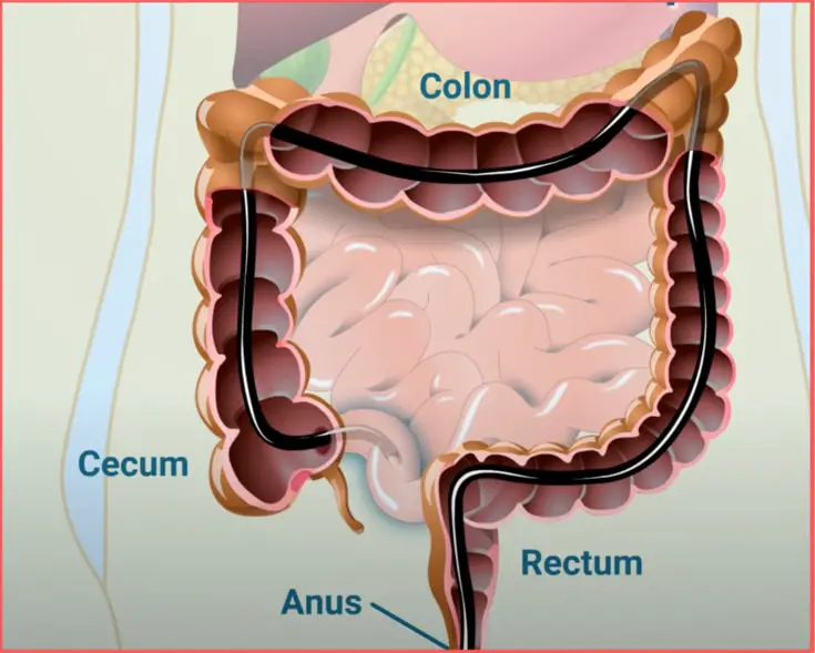 how far does colonoscopy go