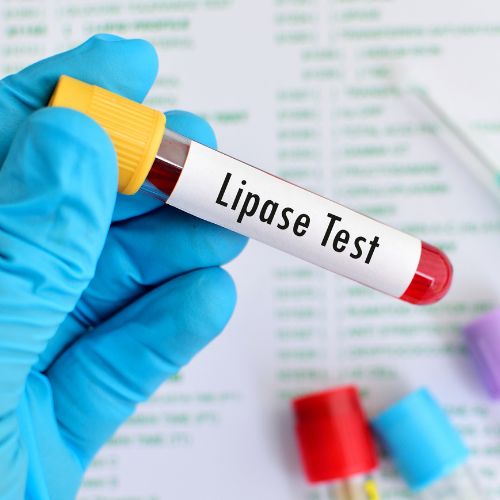 slightly elevated lipase