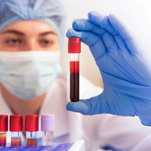 marked alkaline phosphatase elevation causes