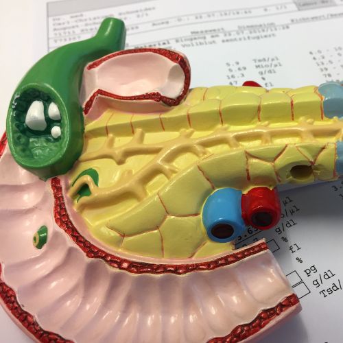 gangrenous cholecystitis gallbladder