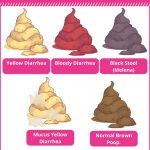 What Does C. Difficile Poop Look Like