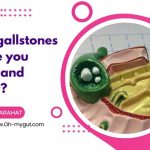 gallstones, dizziness tiredness