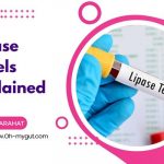 Lipase levels normal range, with causes of elevated and low lipase level.