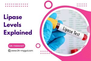 Lipase levels normal range, with causes of elevated and low lipase level.