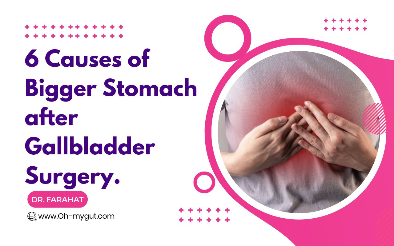 Safest Gallbladder Diet after Surgery (with 60+ Recipes) - Oh My Gut