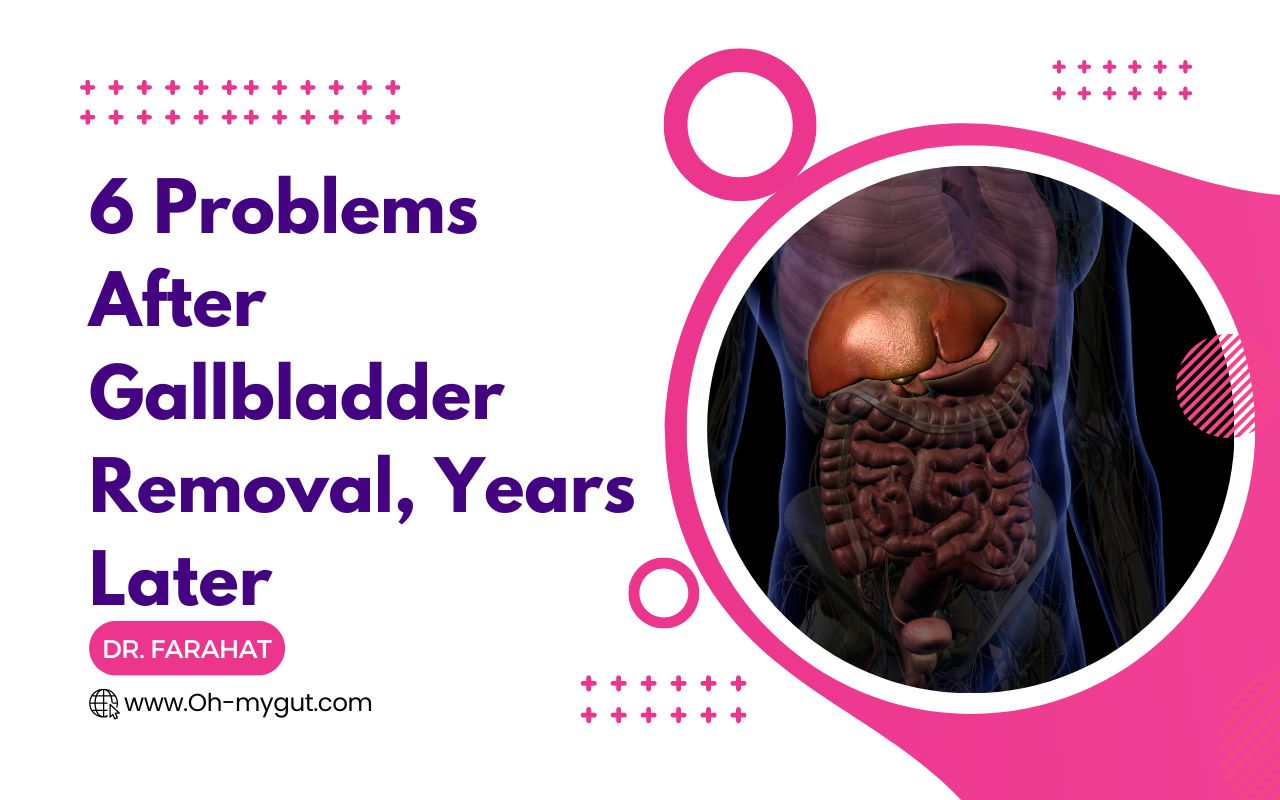 6 Problems After Gallbladder Removal, Years Later (Dr. Farahat) Oh My Gut
